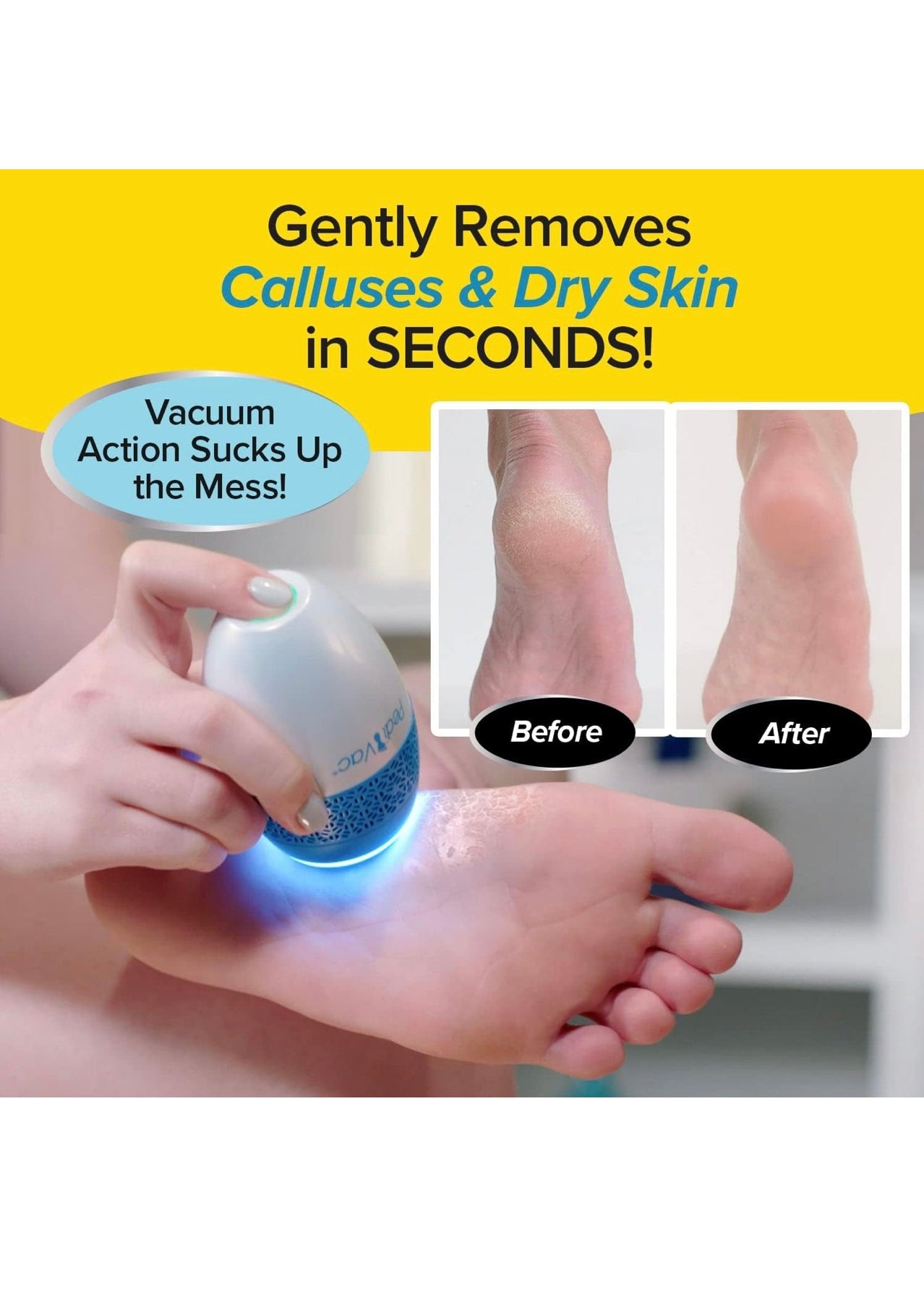 Pedi Vac Electric Callus Remover with Built-in Vacuum